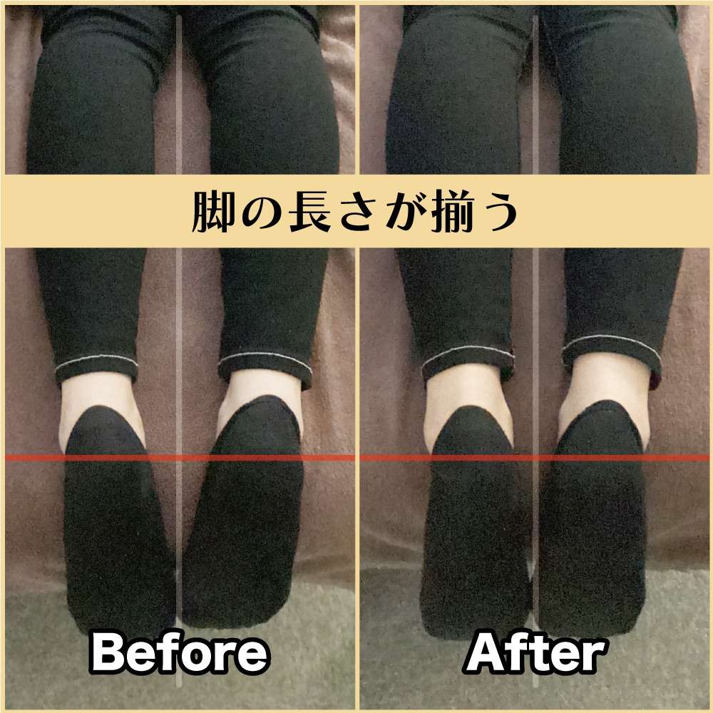 筋膜整体ビフォーアフター！脚の長さが揃う♪｜筋膜整体はたやまきんま君 本町店