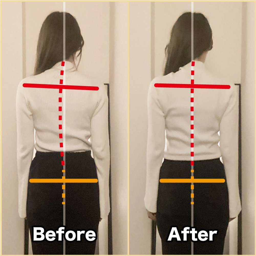 筋膜整体ビフォーアフター！姿勢改善♪｜筋膜整体はたやまきんま君 本町店