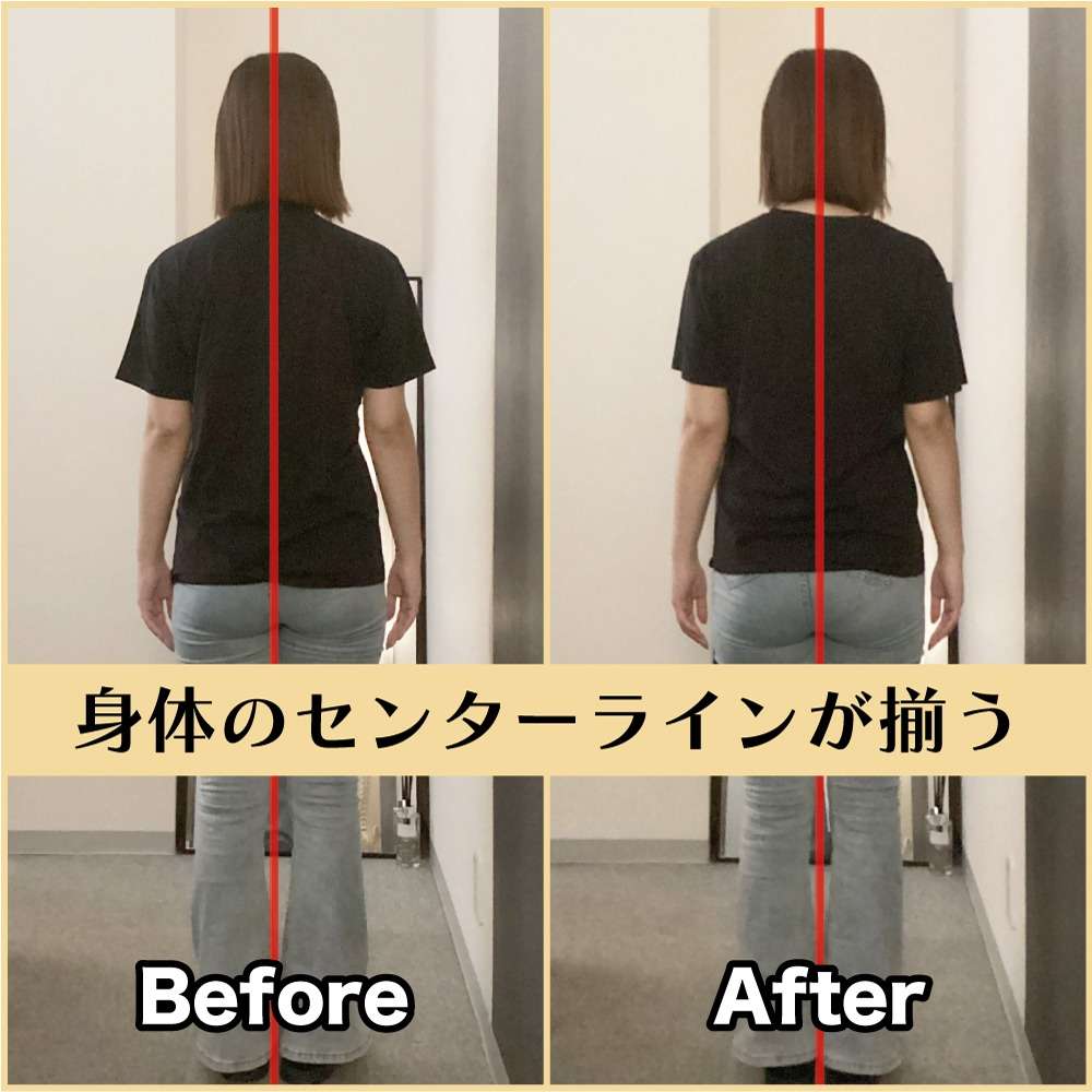 筋膜整体ビフォー＆アフター！側弯を改善♪｜筋膜整体はたやまきんま君 本町店