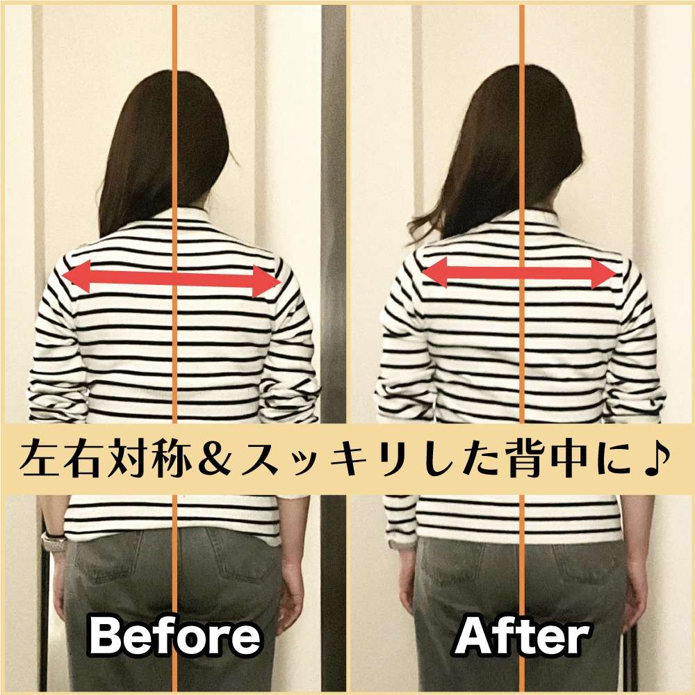 筋膜整体ビフォー&アフター!左右対称なスッキリ背中に♪ |筋膜整体はたやまきんま君 本町店