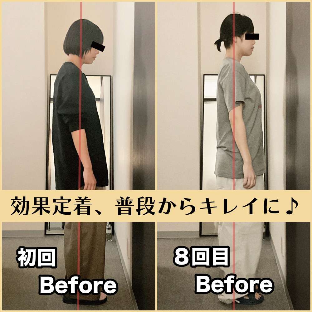 筋膜整体の効果が定着し、普段の姿勢がキレイに💃🕺｜筋膜整体はたやまきんま君 本町店
