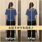 筋膜整体ビフォー&アフター!身体の歪みを改善♪|筋膜整体はたやまきんま君 本町店