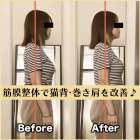 筋膜整体ビフォー＆アフター！猫背・巻き肩が原因でした😭｜筋膜整体はたやまきんま君 本町店