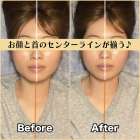 筋膜小顔矯正ビフォー&アフター!お顔の歪みの原因は首!?|筋膜整体はたやまきんま君 本町店