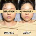 筋膜小顔矯正ビフォー＆アフター！エラ張りを解消♪｜筋膜整体はたやまきんま君 本町店